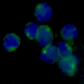 LOX Rabbit mAb ABZ2599