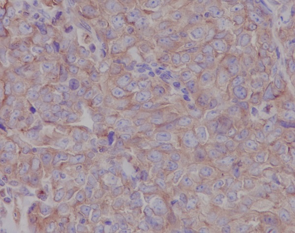 LOX Rabbit mAb ABZ2599