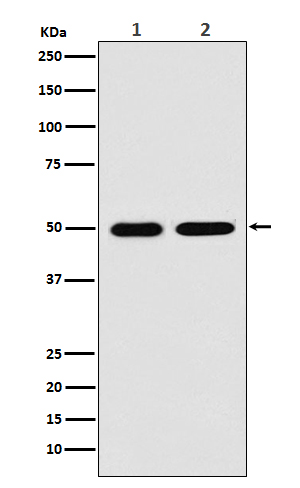 LOX Rabbit mAb ABZ2599