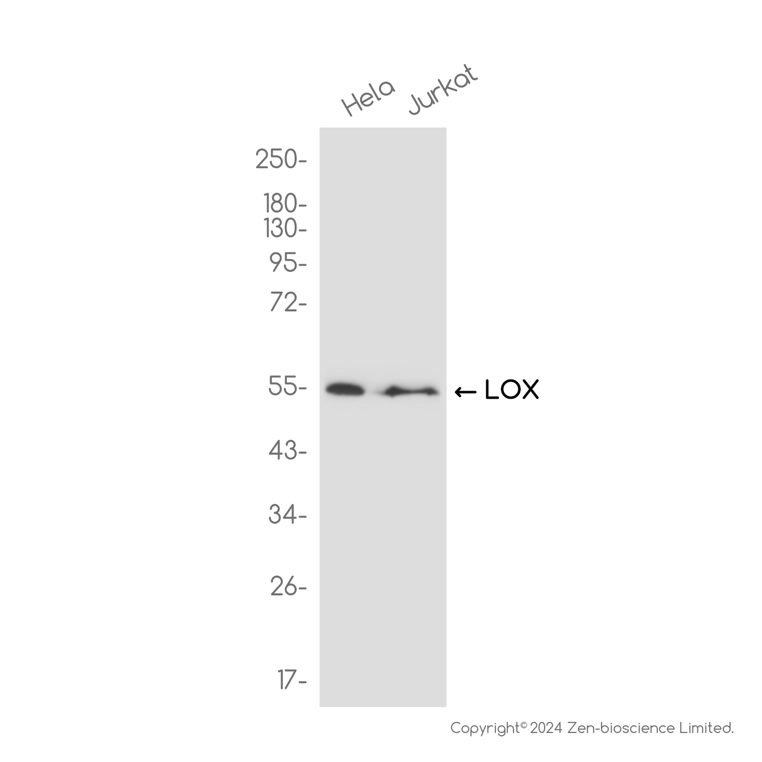 LOX Rabbit mAb ABZ2599