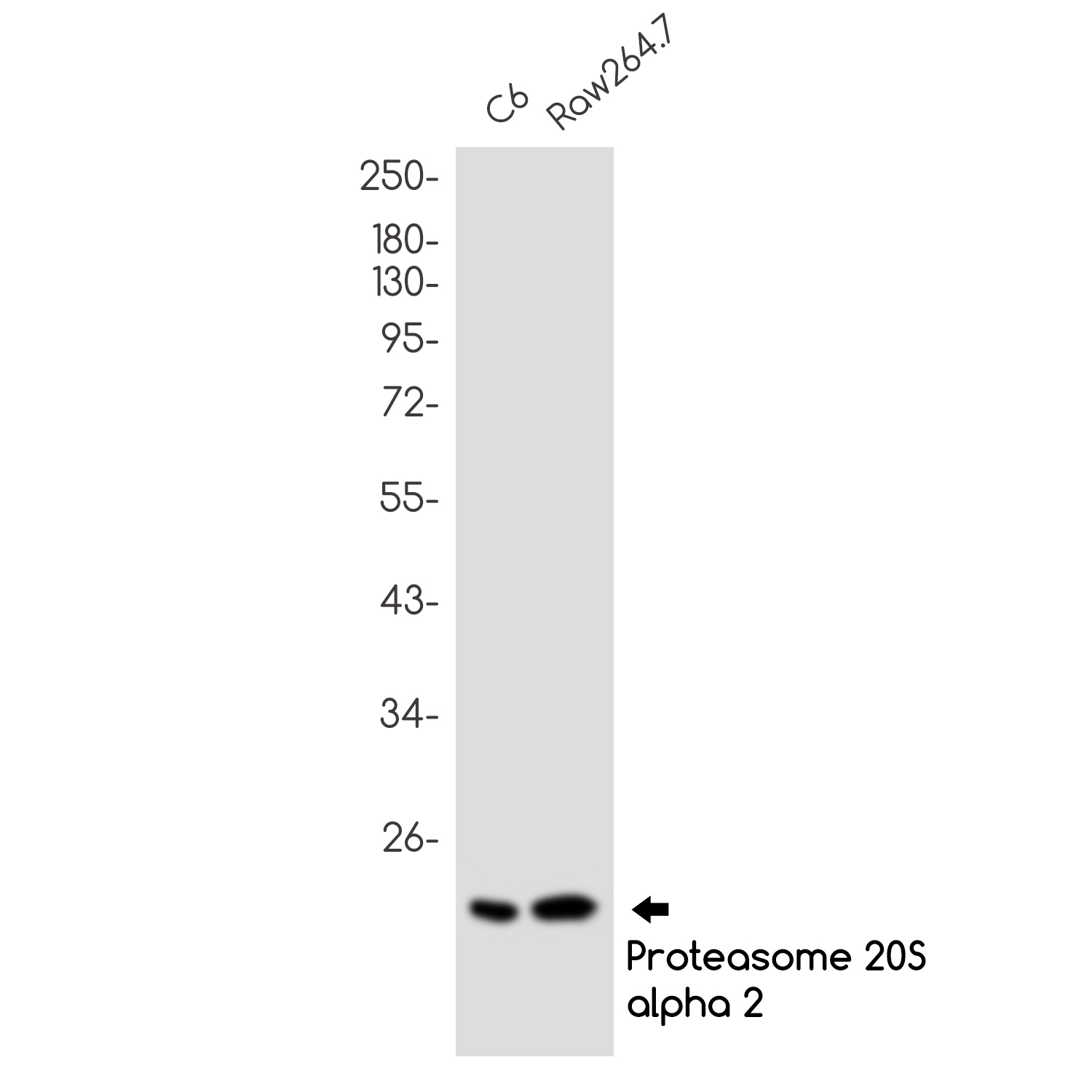 PSMB9 Rabbit mAb ABZ2600
