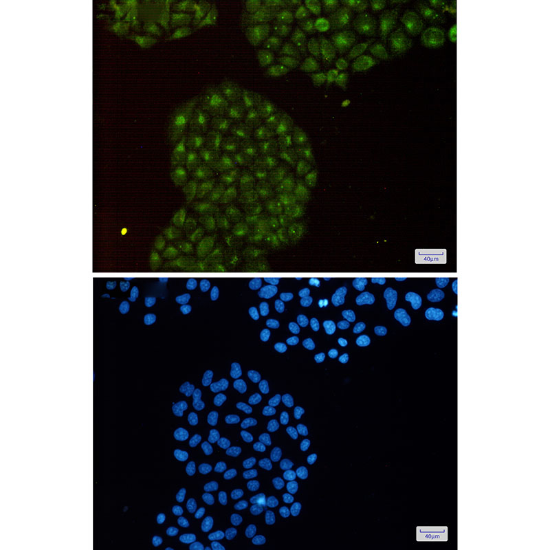 PSMB8 Rabbit mAb ABZ2601