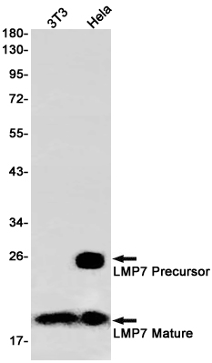 PSMB8 Rabbit mAb ABZ2601