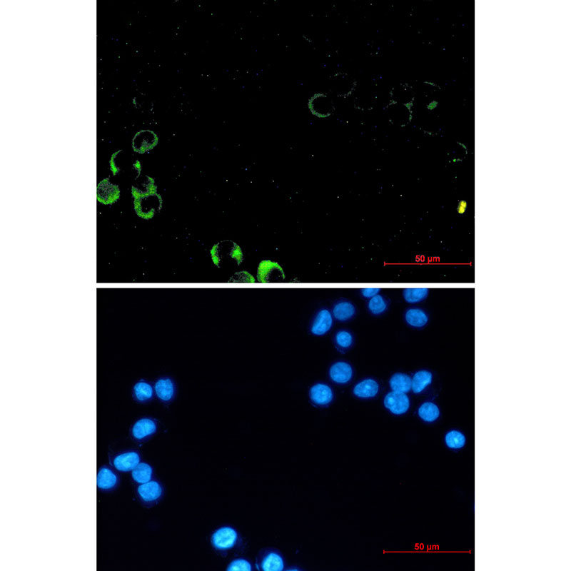 PI3 Kinase p85 alpha Rabbit mAb ABZ2603