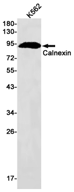 Calnexin Rabbit mAb ABZ2604