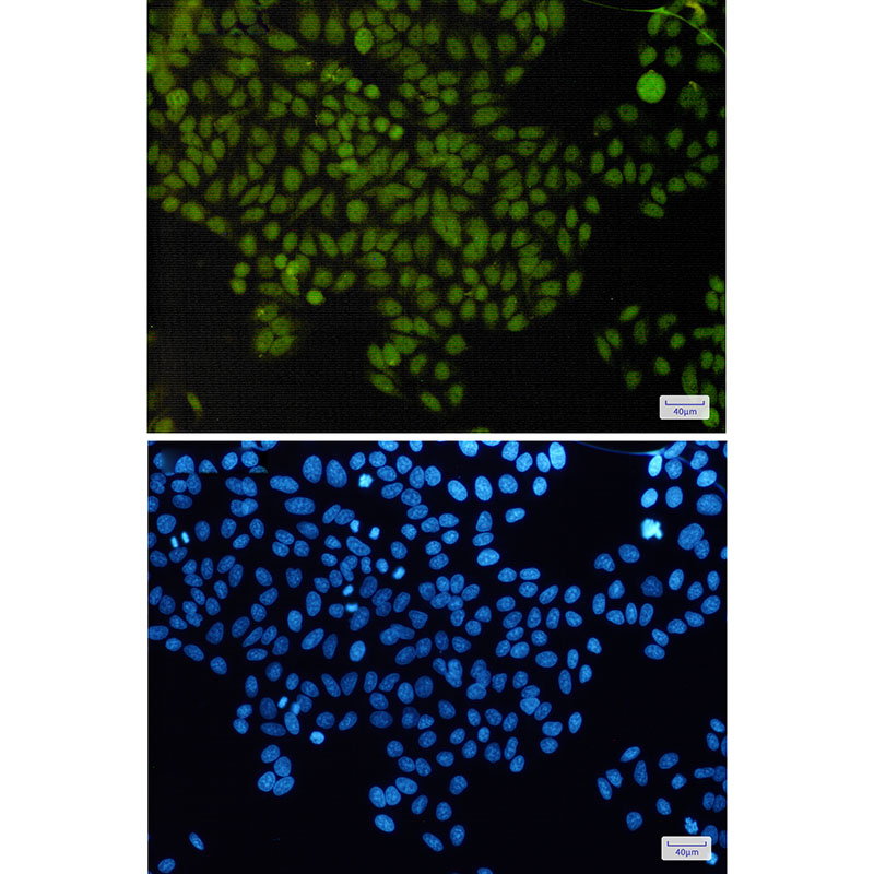 APE1 Rabbit mAb ABZ2605