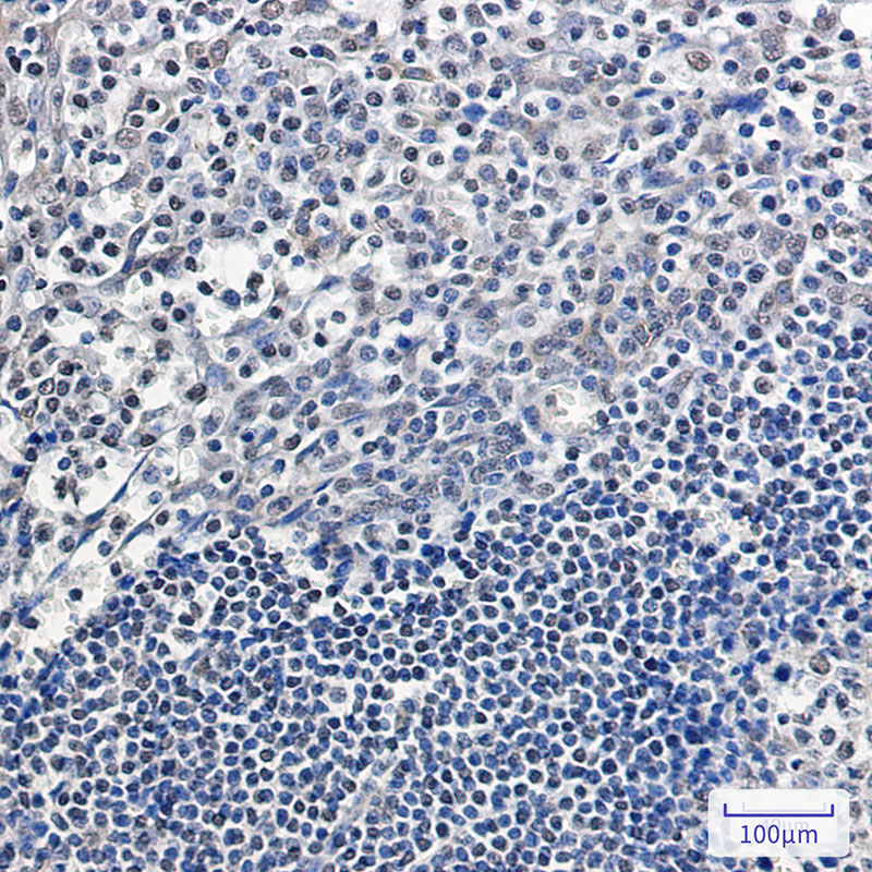 APE1 Rabbit mAb ABZ2605