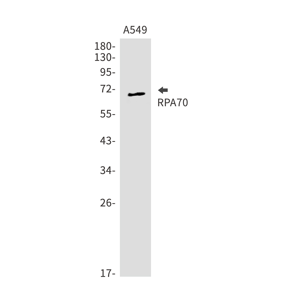 RPA70 Rabbit mAb ABZ2606