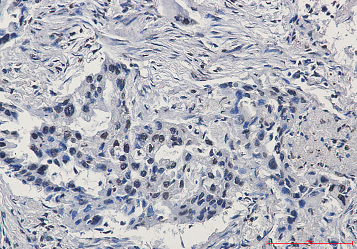 HIF1 beta Rabbit mAb ABZ2607