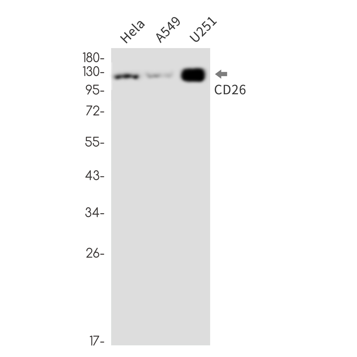 DPP4 Rabbit mAb ABZ2608