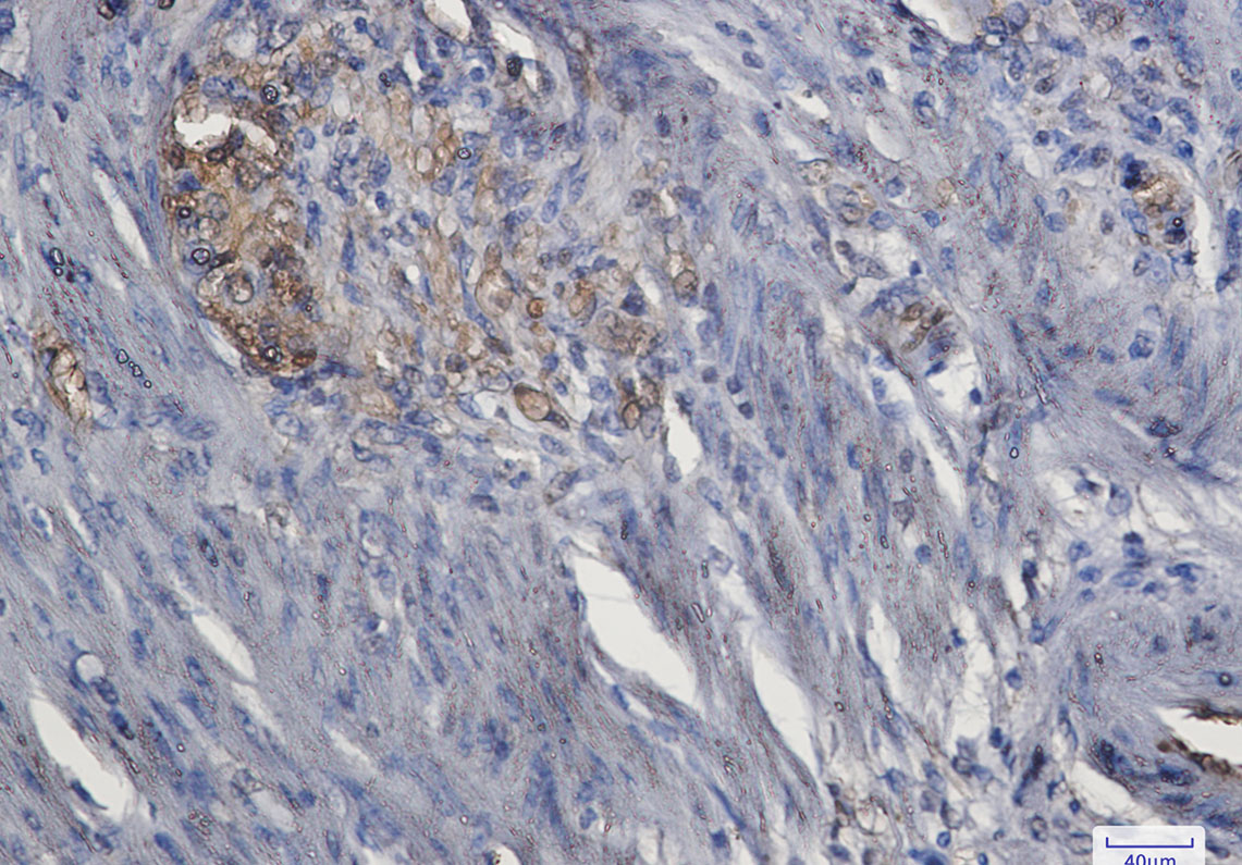 ERK1 Rabbit mAb ABZ2609