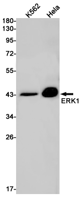ERK1 Rabbit mAb ABZ2609