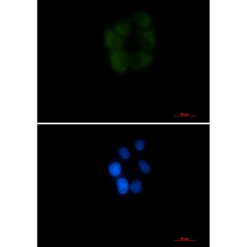 AK3L1 Rabbit mAb ABZ2611