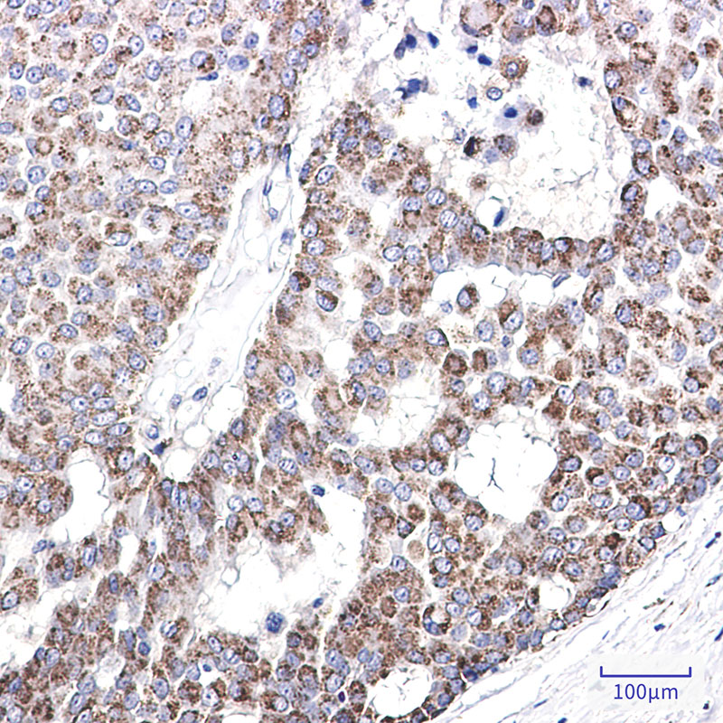 AK3L1 Rabbit mAb ABZ2611