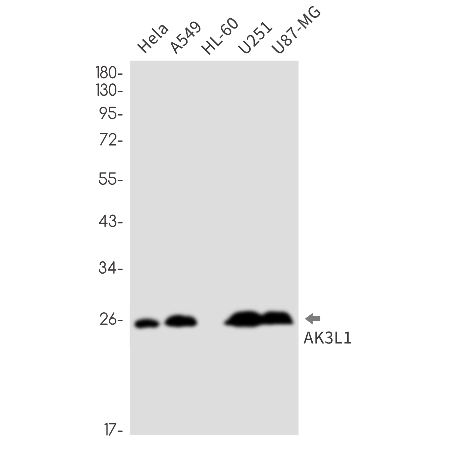 AK3L1 Rabbit mAb ABZ2611