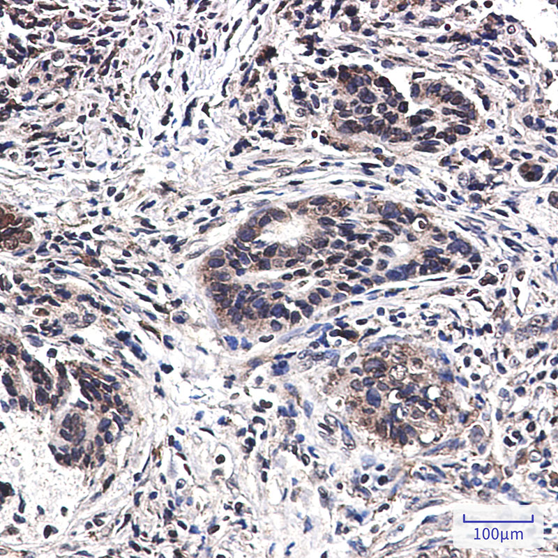 MST1 Rabbit mAb ABZ2612
