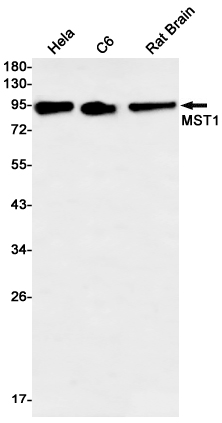 MST1 Rabbit mAb ABZ2612