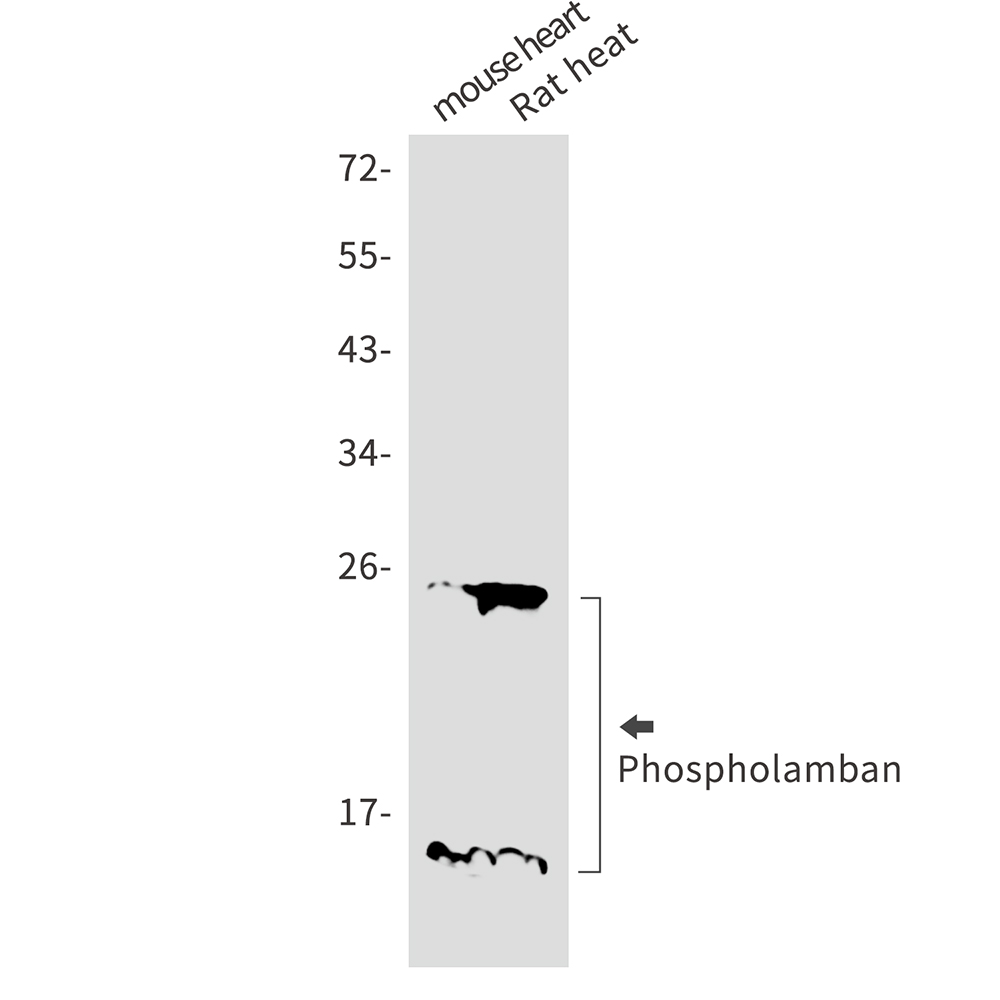Phospholamban Rabbit mAb ABZ2614