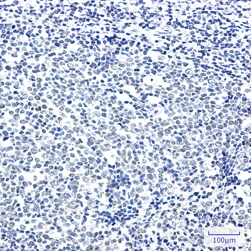 PTBP1 Rabbit mAb ABZ2615