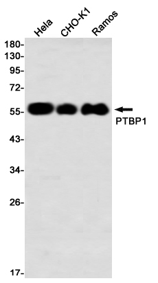 PTBP1 Rabbit mAb ABZ2615