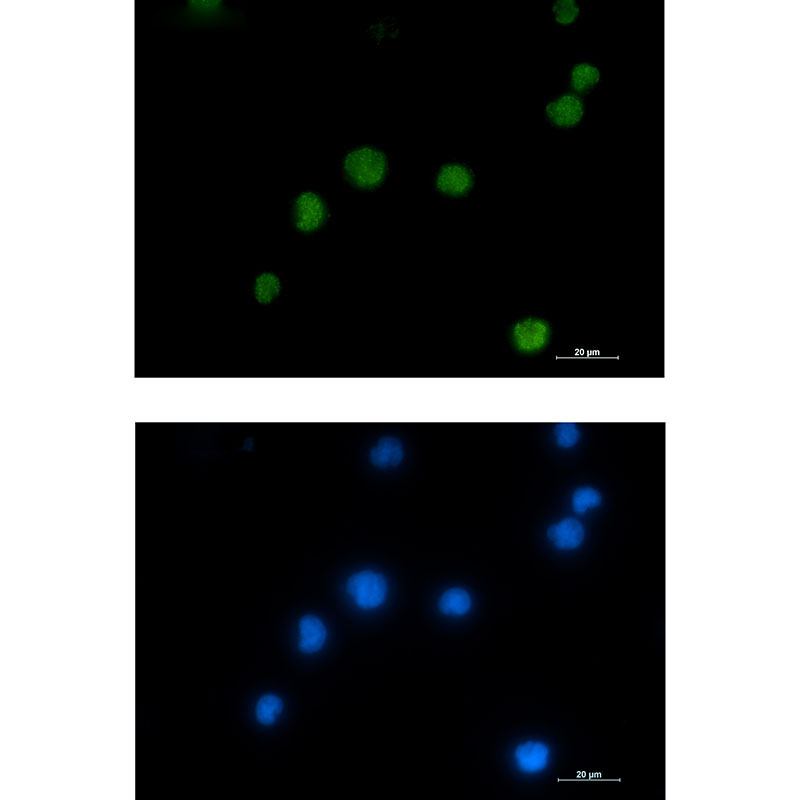 HMGB2 Rabbit mAb ABZ2616