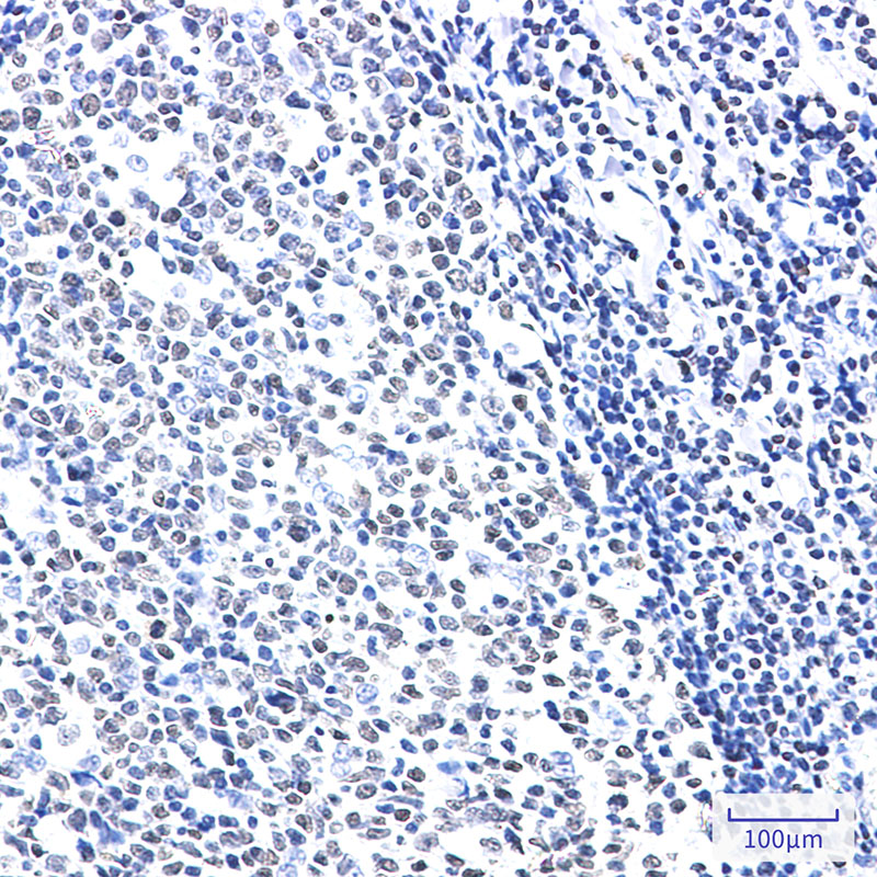 HMGB2 Rabbit mAb ABZ2616