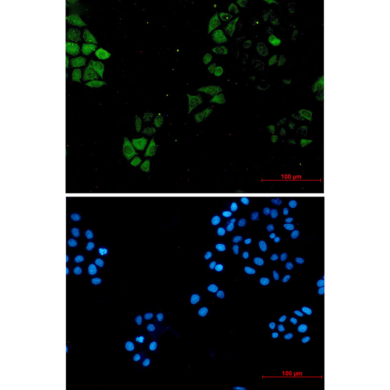 S100A4 Rabbit mAb ABZ2617