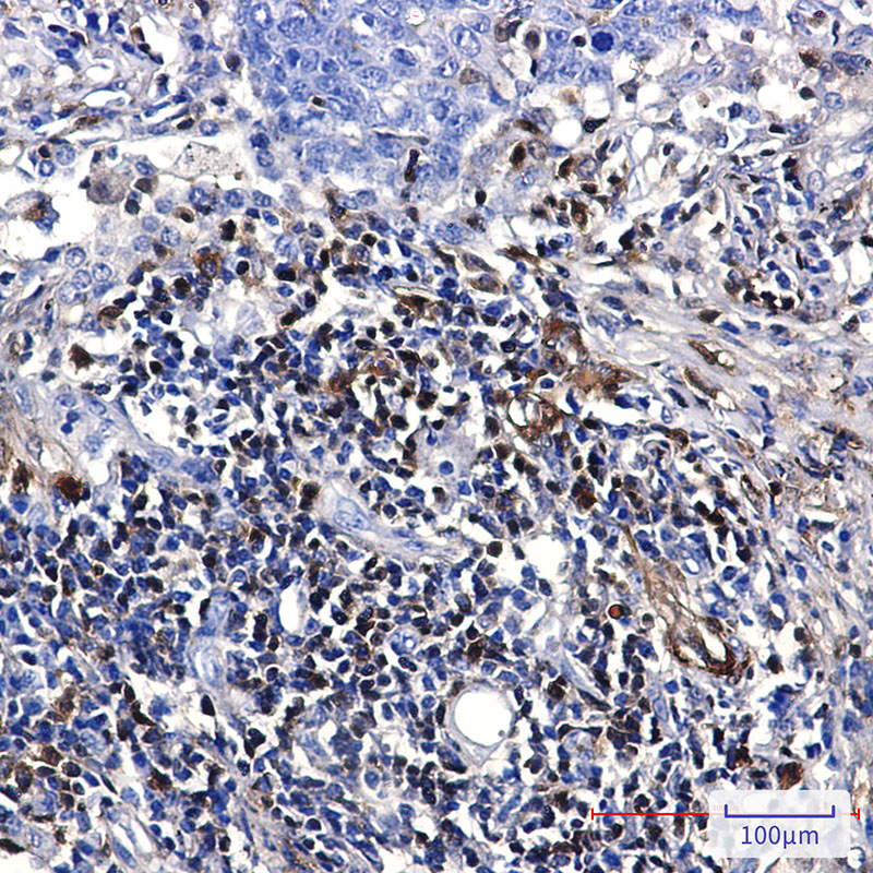 S100A4 Rabbit mAb ABZ2617