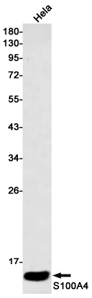 S100A4 Rabbit mAb ABZ2617