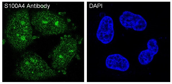 S100A4 Rabbit mAb ABZ2618