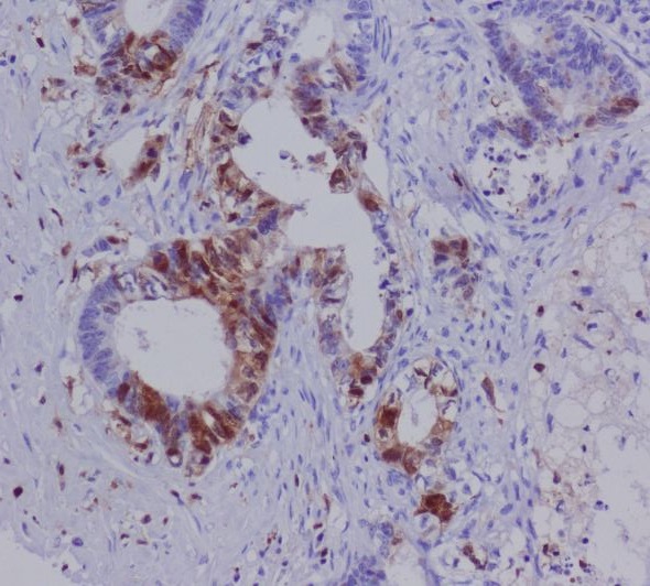 S100A4 Rabbit mAb ABZ2618