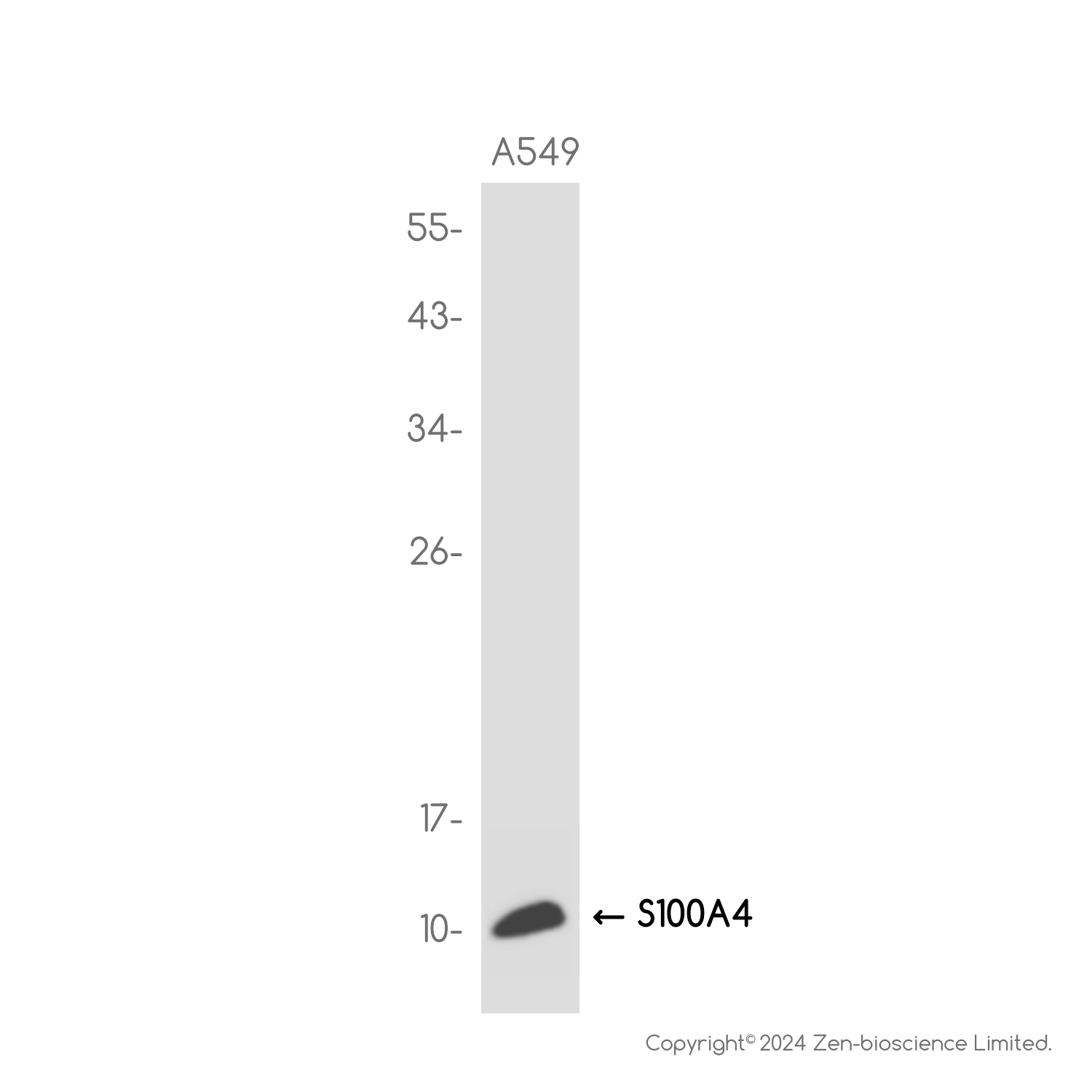 S100A4 Rabbit mAb ABZ2618