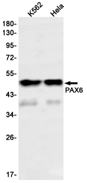 PAX6 Rabbit mAb ABZ2619