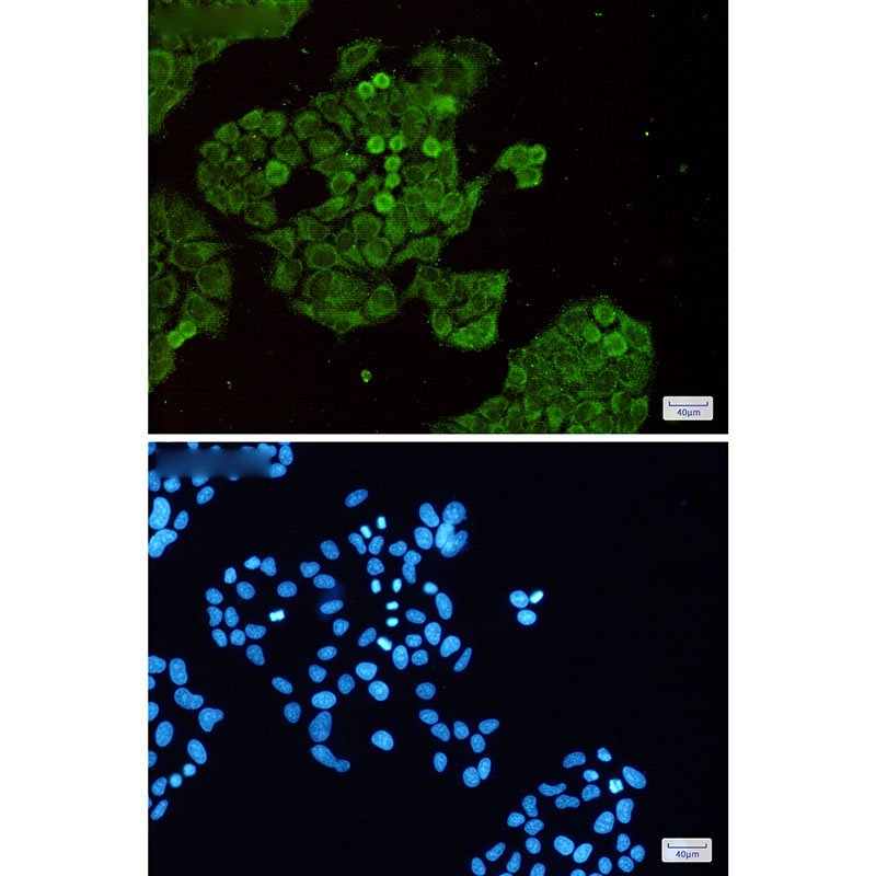 Dnmt1 Rabbit mAb ABZ2620