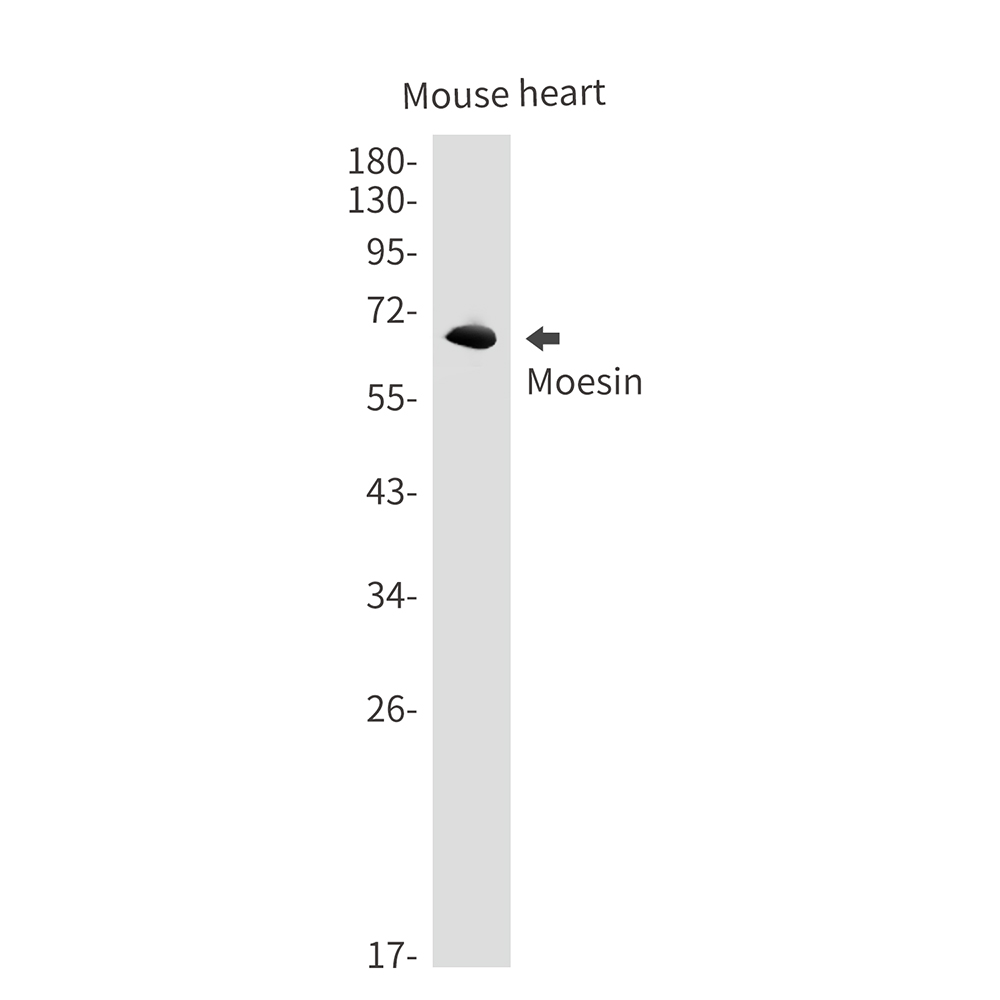Moesin Rabbit mAb ABZ2621