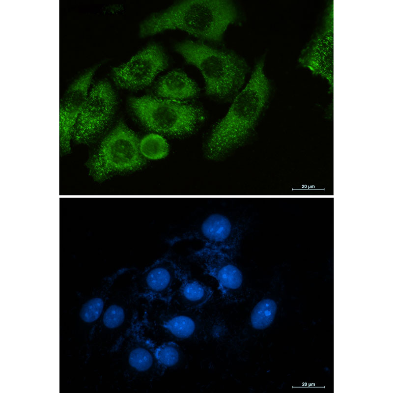 Moesin Rabbit mAb ABZ2622