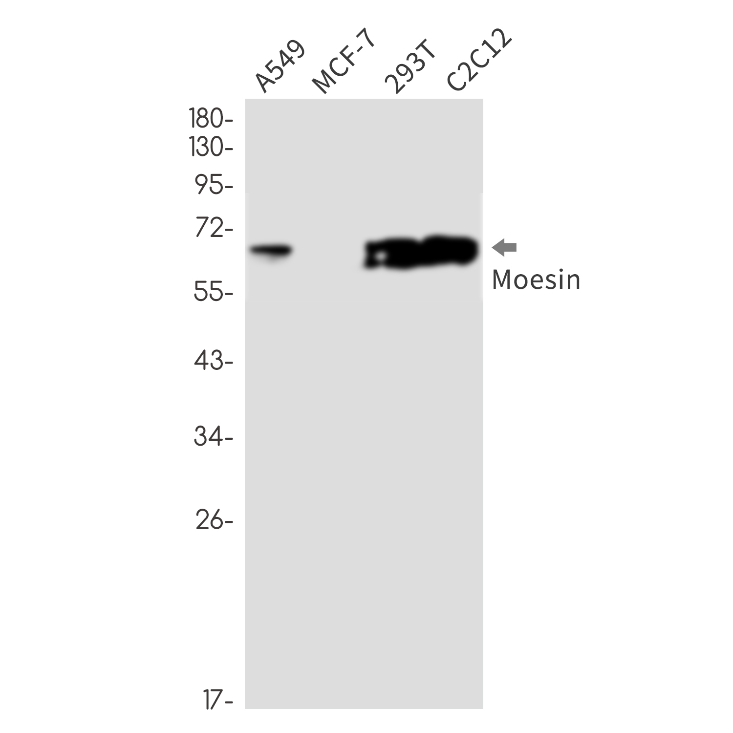 Moesin Rabbit mAb ABZ2622