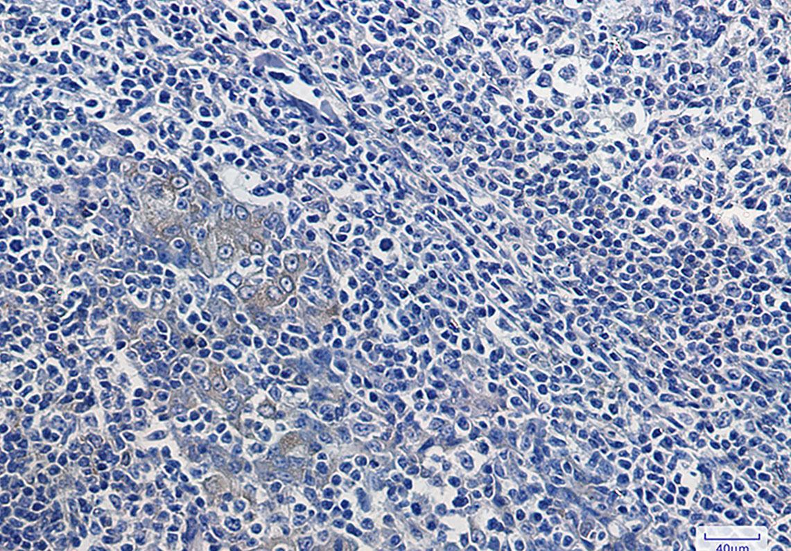 IKB alpha Rabbit mAb ABZ2623