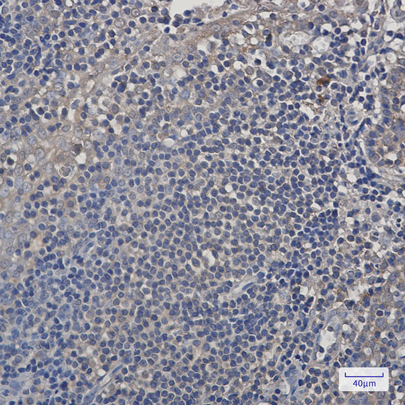 PSMA4 Rabbit mAb ABZ2626