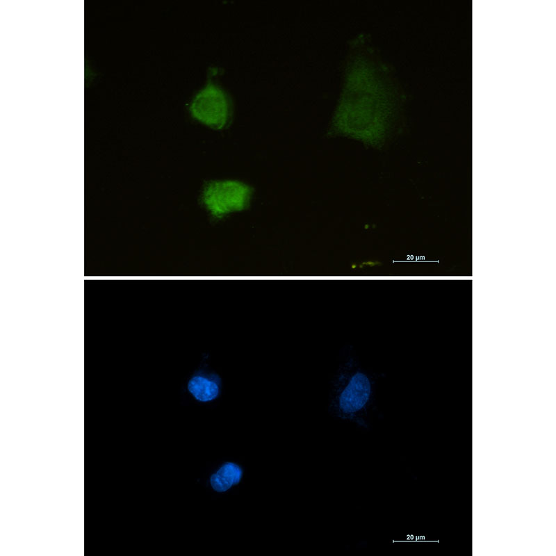 PSMA2 Rabbit mAb ABZ2627