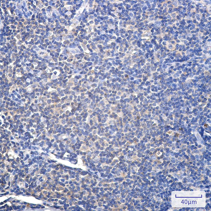 PSMA2 Rabbit mAb ABZ2627
