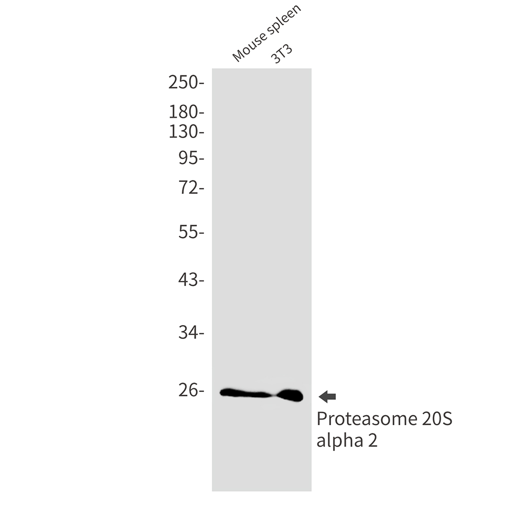 PSMA2 Rabbit mAb ABZ2627