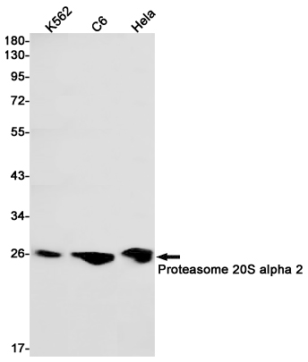 PSMA2 Rabbit mAb ABZ2627