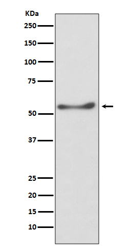 ATP5A Rabbit mAb ABZ2628