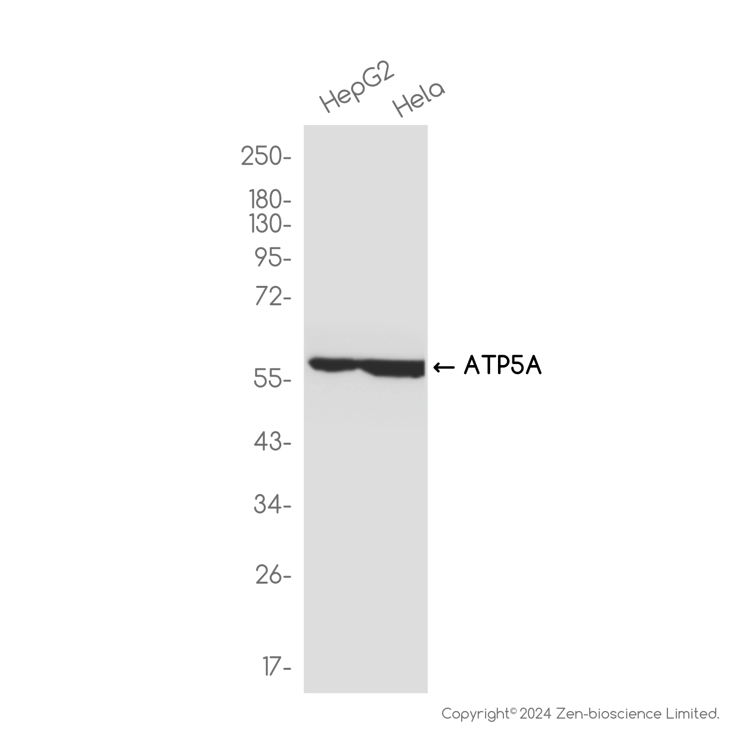 ATP5A Rabbit mAb ABZ2628