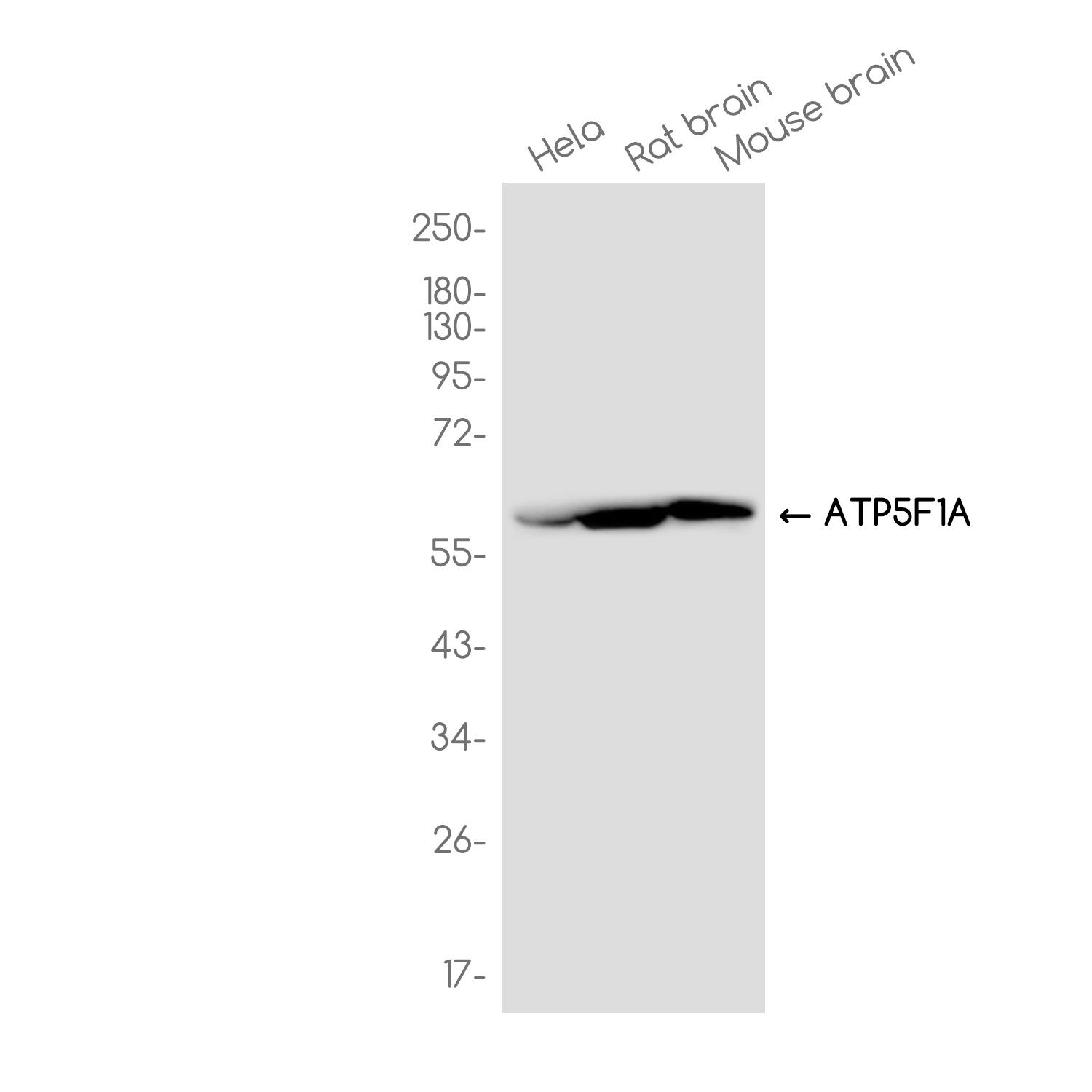 ATP5A Rabbit mAb ABZ2628