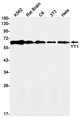 YY1 Rabbit mAb ABZ2629