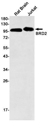 BRD2 Rabbit mAb ABZ2631