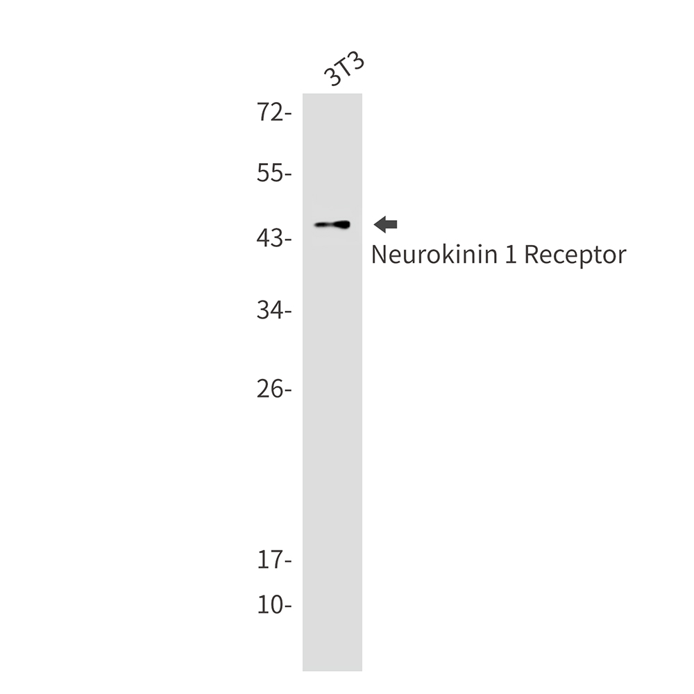 Neurokinin 1 Receptor Rabbit mAb ABZ2634