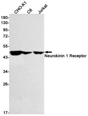 Neurokinin 1 Receptor Rabbit mAb ABZ2634